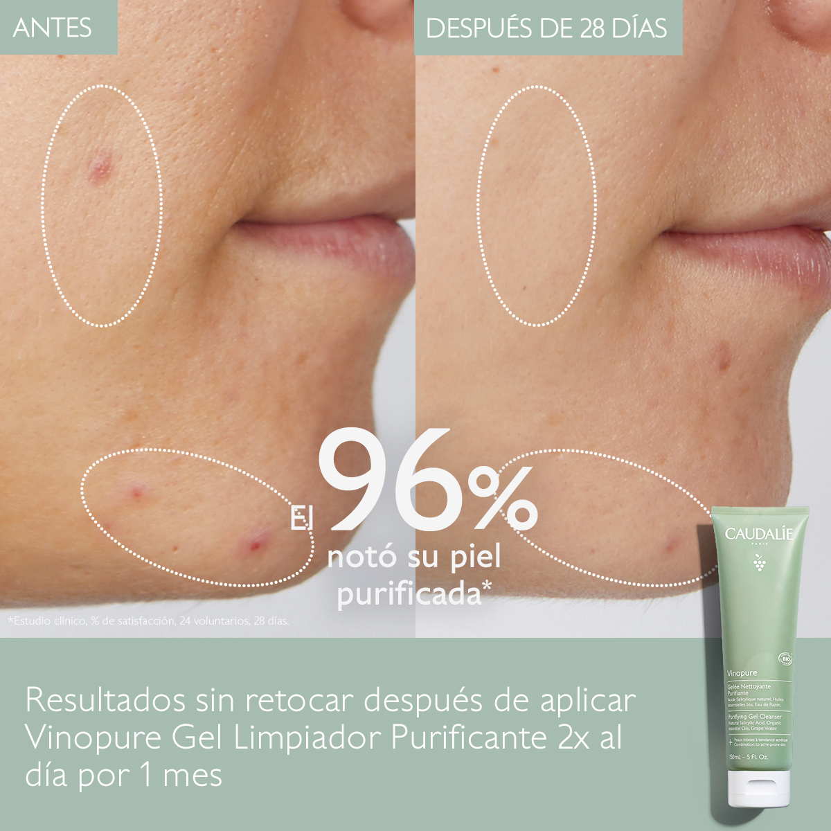 VINOPURE PORE PURIFYING GEL CLEANSER (GEL LIMPIADOR PURIFICANTE)