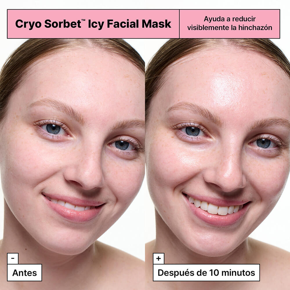 CRYO SORBET&trade; (MASCARILLA FACIAL PARA DESINFLAMAR)