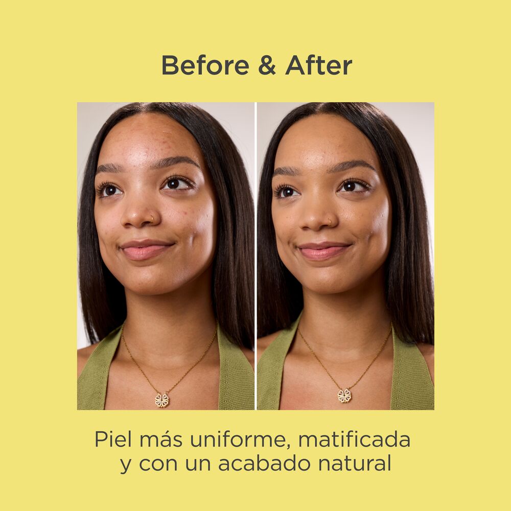 ACNIBEN CC CREAM SPF30 (CREMA SEBORREGULADORA CON COLOR Y PROTECCI&Oacute;N)